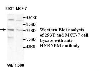 Anti-HNRNPM