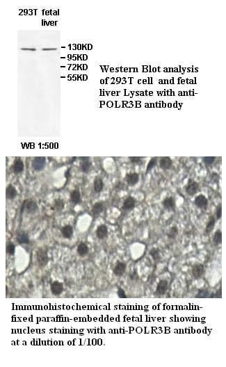 Anti-POLR3B