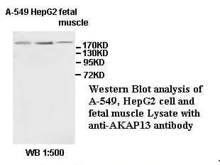 Anti-AKAP13