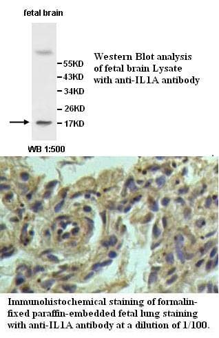 Anti-IL1A