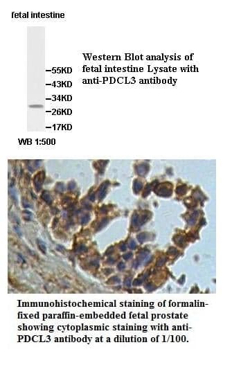 Anti-PDCL3