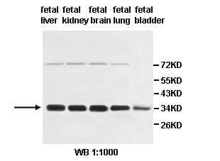 Anti-HSD17B13
