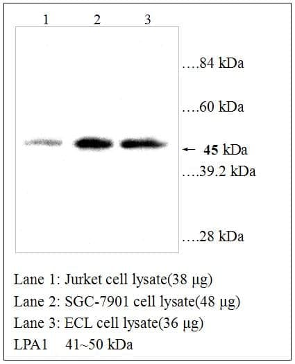 Anti-LPA 1