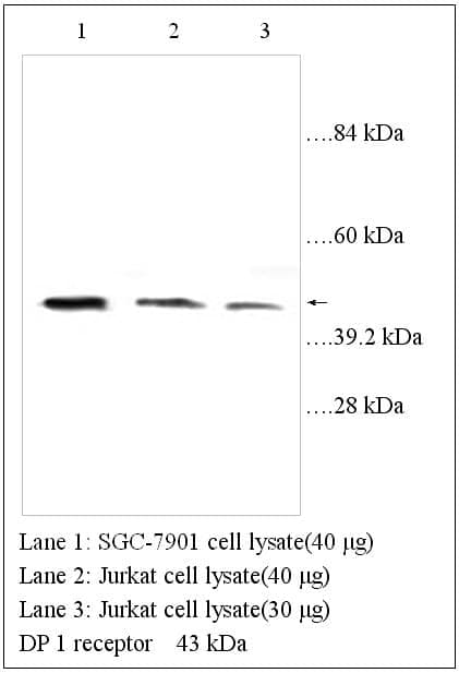 Anti-DP1 receptor