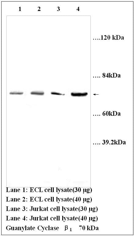 Anti-Guanylate Cyclase &szlig;1 subunit(soluble)