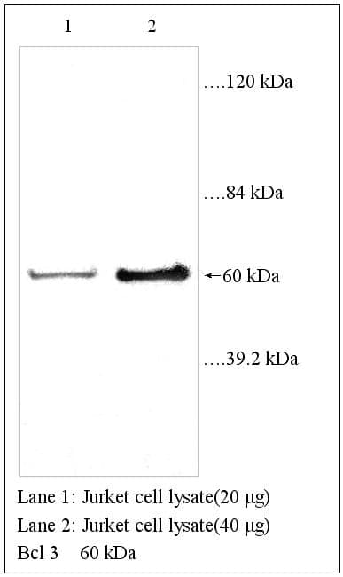 Anti-Bcl-3