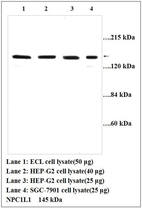 Anti-NPC1L1