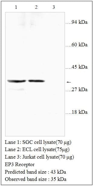 Anti-EP3 Receptor