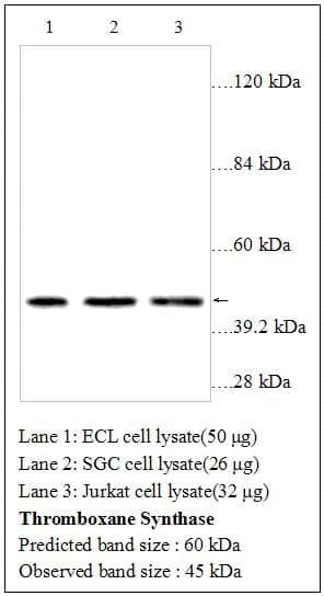 Anti-Thromboxane synthase