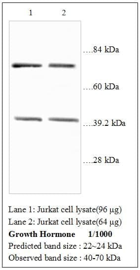 Anti-Growth Hormone