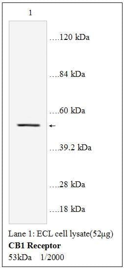 Anti-CB1 Receptor