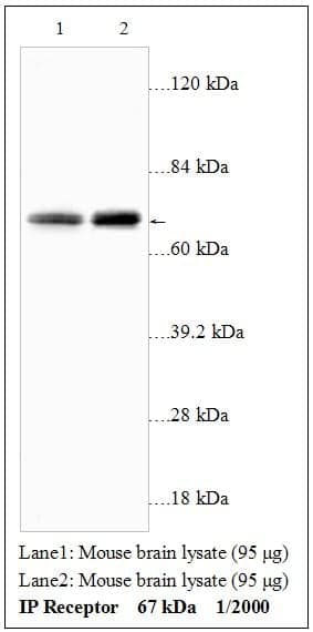 Anti-IP Receptor