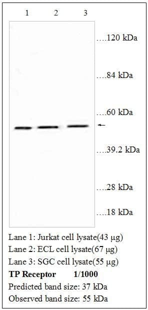 Anti-TP Receptor