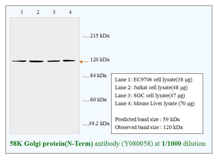Anti-58K Golgi protein(N-Term)