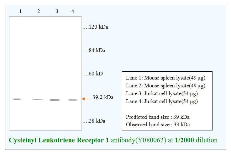 Anti-Cysteinyl Leukotriene Receptor 1