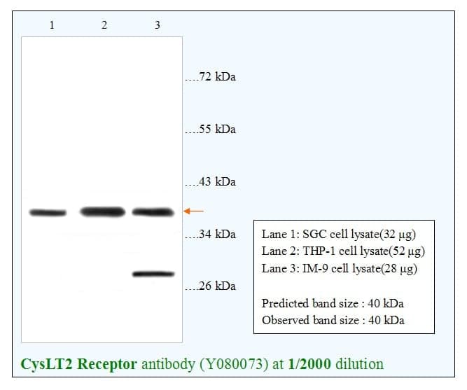 Anti-CysLT2 Receptor