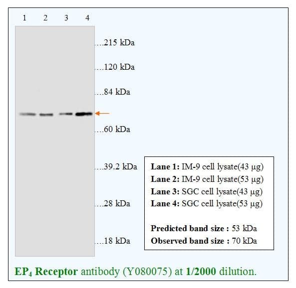Anti-EP4 Receptor