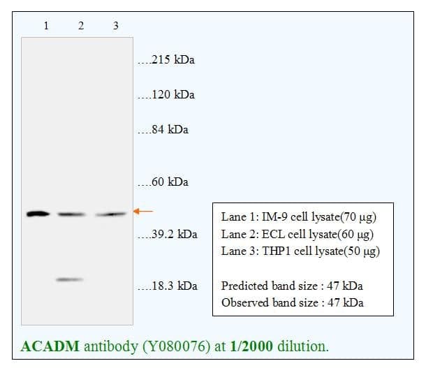Anti-ACADM