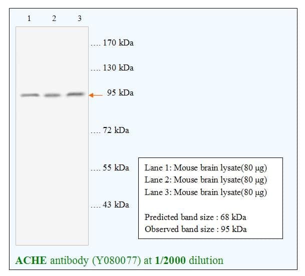 Anti-Acetylcholinesterase(ACHE)