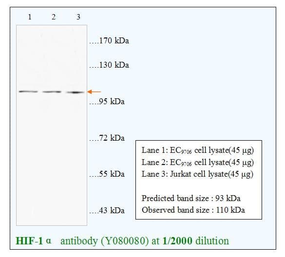 Anti-HIF-1&szlig;