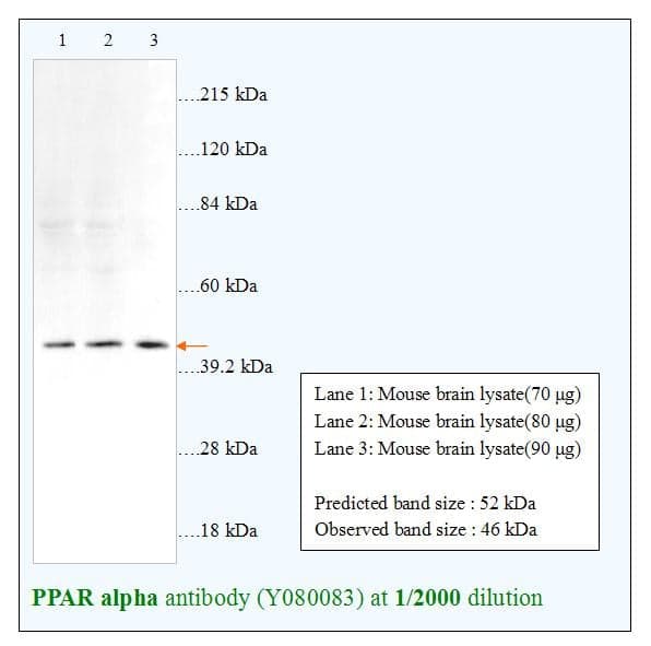 Anti-PPAR alpha
