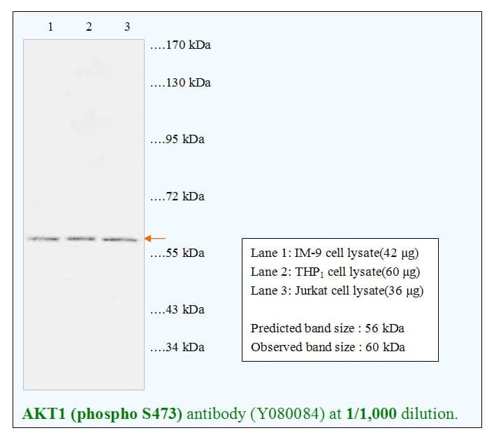 Anti-AKT1 (phospho S473)