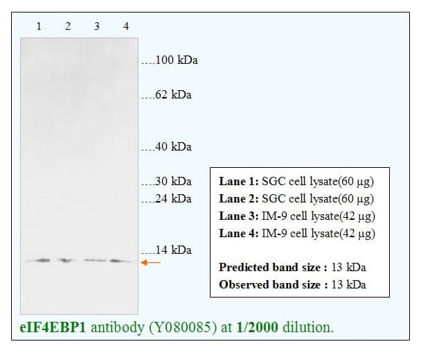 Anti-eIF4EBP1