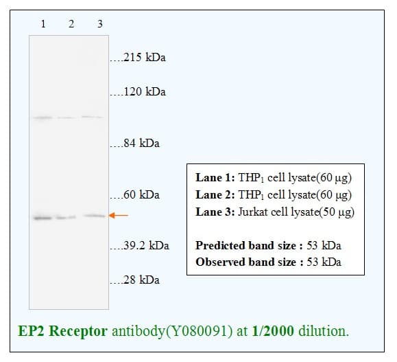 Anti-EP2 Receptor