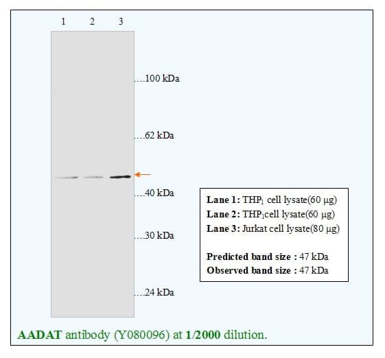 Anti-AADAT