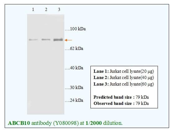 Anti-ABCB10