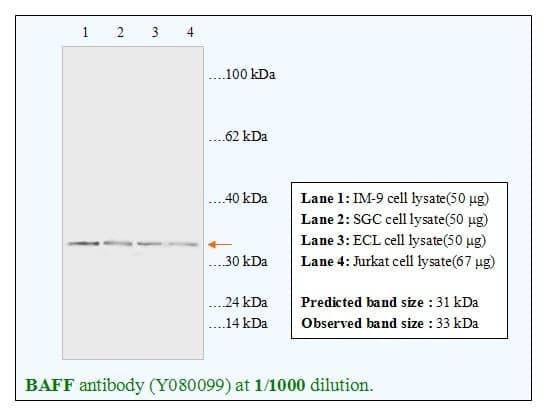 Anti-BAFF(B cell activating factor)
