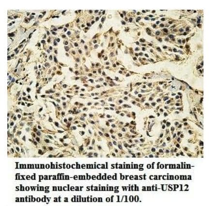 Anti-USP12