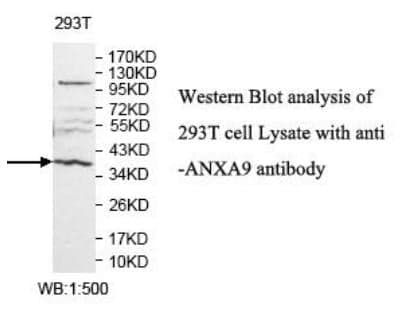Anti-ANXA9