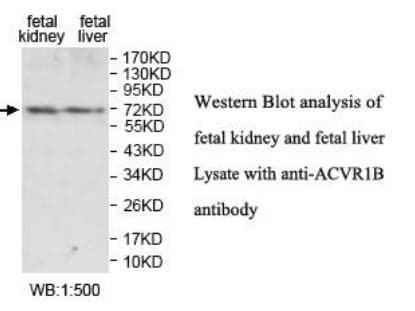 Anti-ACVR1B