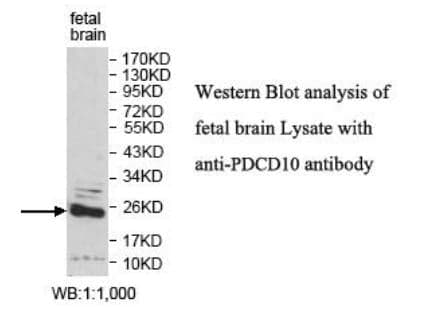 Anti-PDCD10