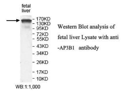 Anti-AP3B1
