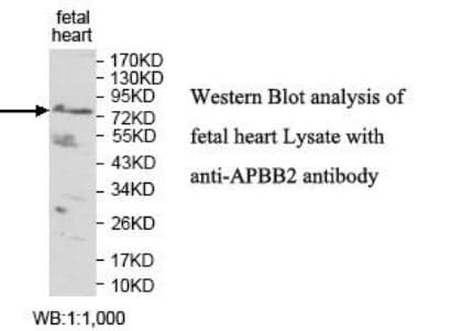 Anti-APBB2