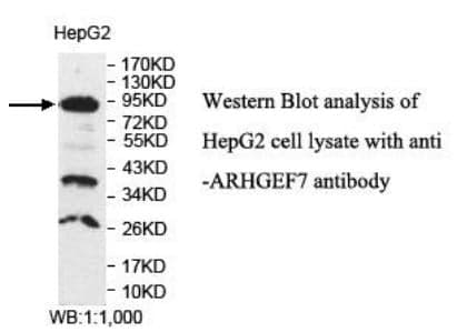Anti-ARHGEF7