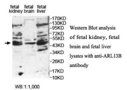 Anti-ARL13B