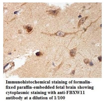 Anti-FBXW11