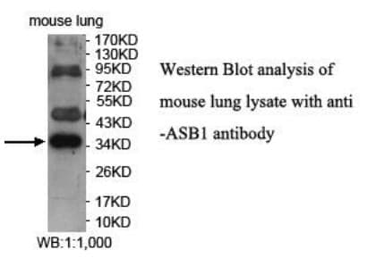 Anti-ASB1