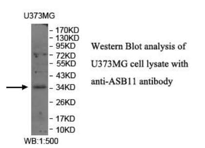 Anti-ASB11