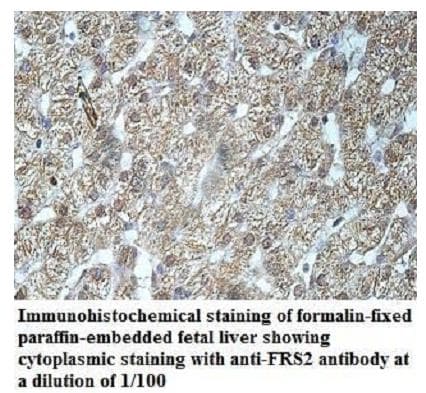 Anti-FRS2