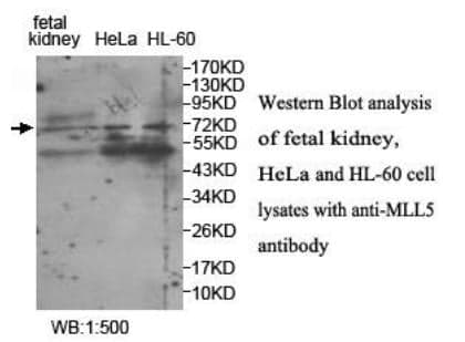Anti-MLL5