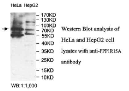 Anti-PPP1R15A
