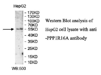 Anti-PPP1R16A