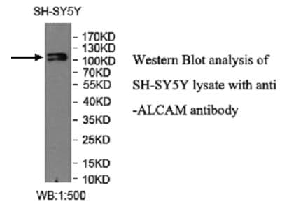 Anti-ALCAM