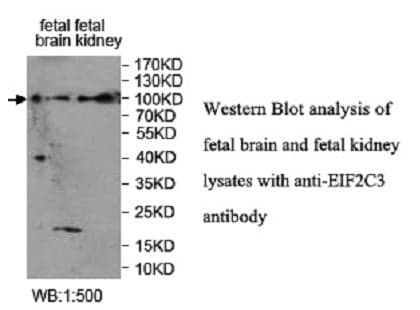 Anti-EIF2C3