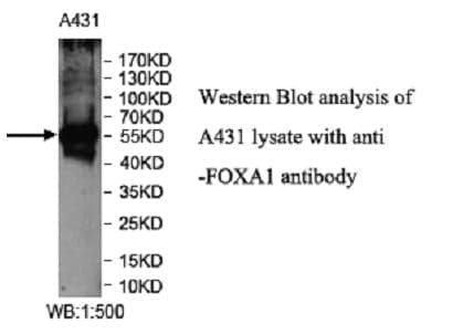 Anti-FOXA1