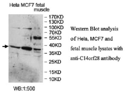 Anti-C14ORF28